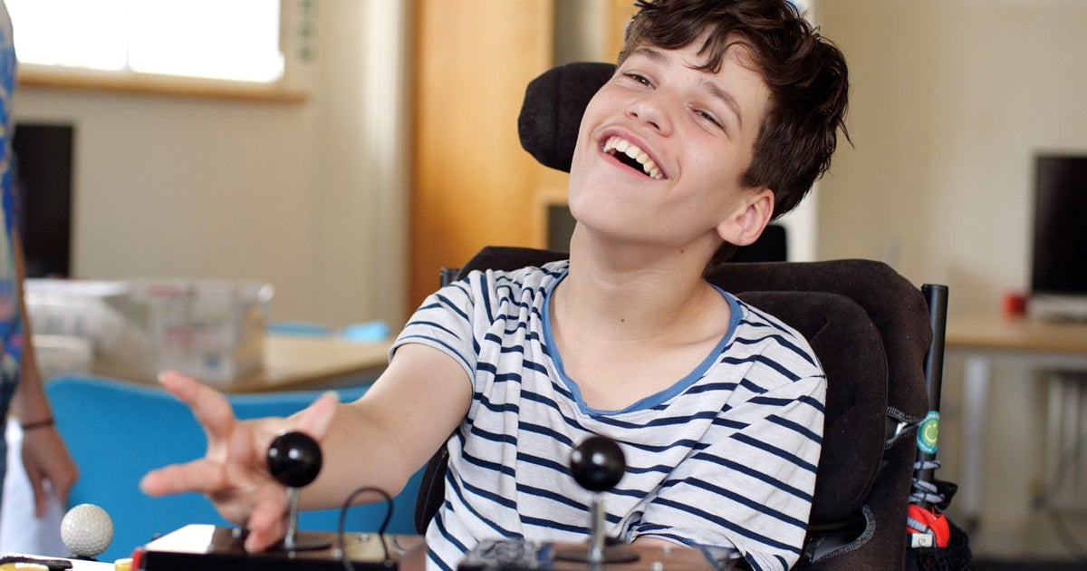 One Big Game: SpecialEffect จัดแมตช์ฟุตบอลการกุศล ระดมทุนกว่า £63,000 ช่วยผู้เล่นร่างกายพิการ